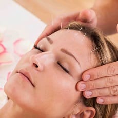 acupuncture 1 طب سوزنی