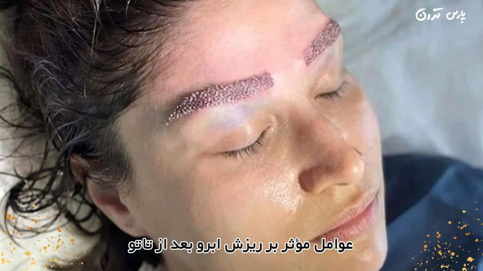 Factors affecting eyebrow loss after tattooing عوامل مؤثر بر ریزش ابرو بعد از تاتو