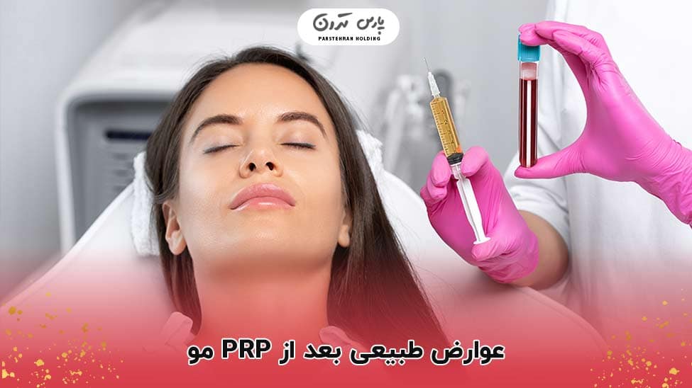 Natural side effects after PRP hair عوارض طبیعی بعد از PRP مو