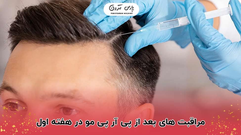 Post PRP hair care in the first week مراقبت های بعد از پی آر پی مو در هفته اول