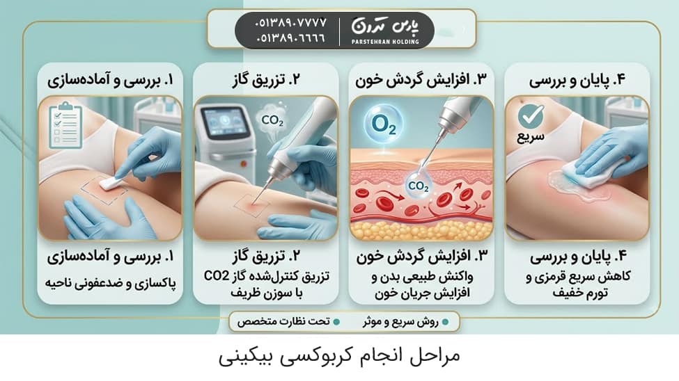 Steps to perform bikini مراحل انجام کربوکسی بیکینی