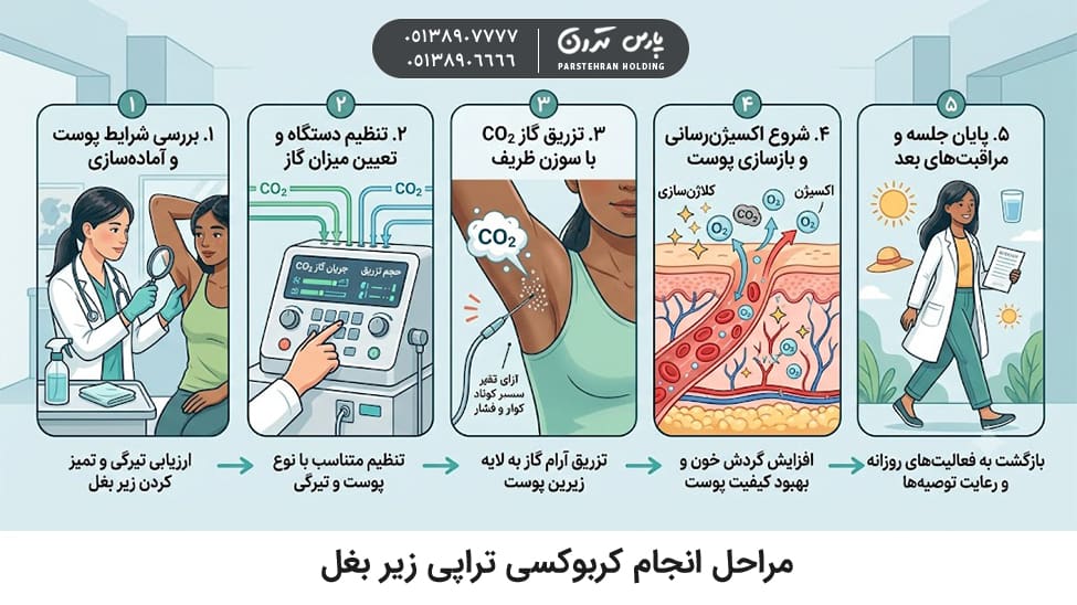 Steps to perform underarm carboxytherapy in Mashhad مراحل انجام کربوکسی تراپی زیر بغل در مشهد
