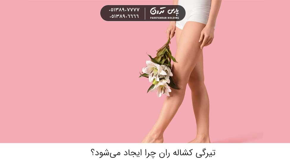 Why does groin darkening occur روشن سازی تیرگی کشاله ران بانوان